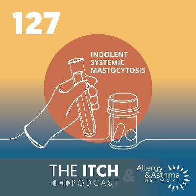 #127 - Management of indolent mastocytosis - A clinical yardstick