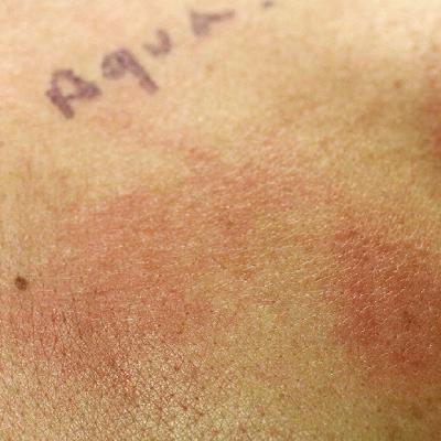 Consumo gusto - Alergias e intolerancias - 25/11/25