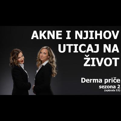 Akne i njihov uticaj na život Akne i njihov uticaj na život