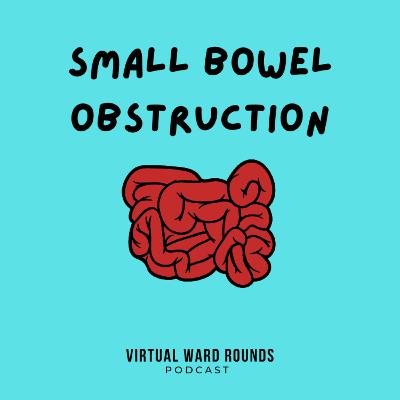 Small Bowel Obstruction part 1 Small Bowel Obstruction part 1