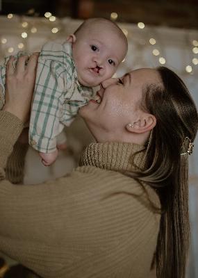 "I Saw the Cleft Before Anyone Told Me.": A Prenatal Cleft Diagnosis in Serbia