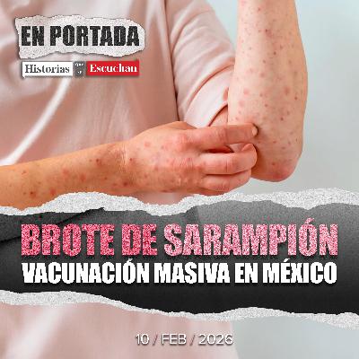 Brote de sarampión en México: autoridades de salud impulsan vacunación