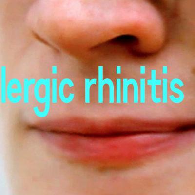 Crap advice: Welcome pollen!