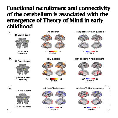 613-Functional connectivity of the cerebellum