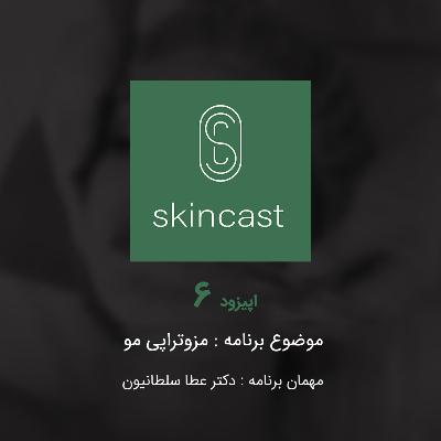 اپیزود ششم : مزوتراپی مو