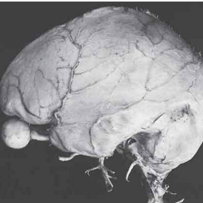 The Brain's Blueprint: From Simple Tube to Conscious Cortex (Section 1) The Brain's Blueprint: From Simple Tube to Conscious Cortex (Section 1)