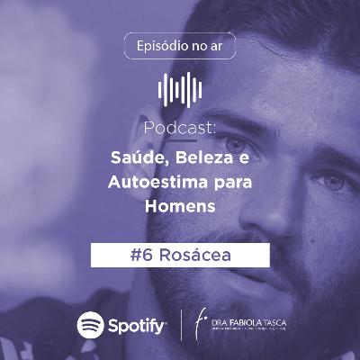 Rosácea