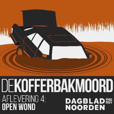 4. Open wond