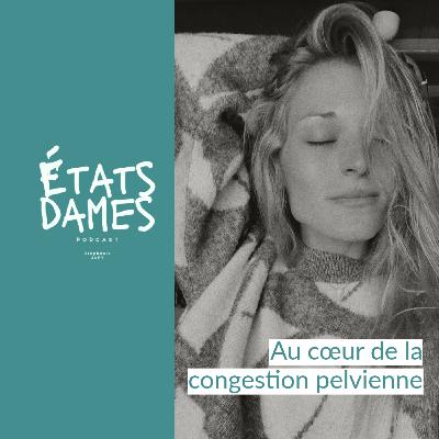 Au cœur de l’endométriose… à la congestion pelvienne