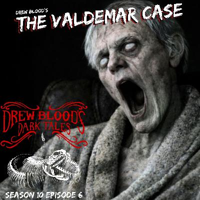S10 Ep6: S10E06 - "The Valdemar Case" - Drew Blood S10 Ep6: S10E06 - "The Valdemar Case" - Drew Blood