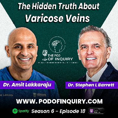 The Hidden Truth About Varicose Veins | Dr. Amit Lakkaraju |  S6 - E18
