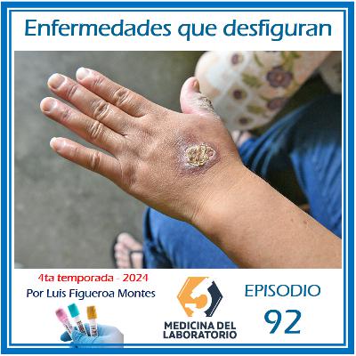 Enfermedades que desfiguran Enfermedades que desfiguran