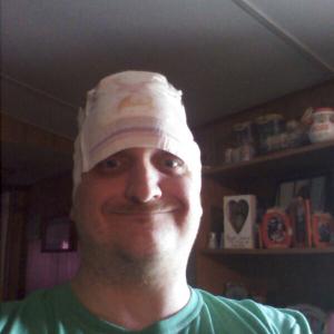 Diaper Rash