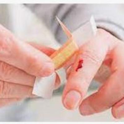 CORTES HERIDAS COLICOS Y OTROS. CORTES HERIDAS COLICOS Y OTROS.