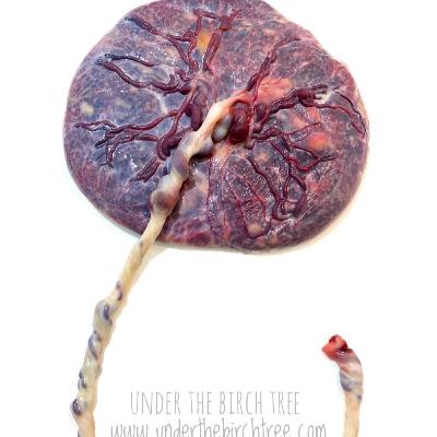 EPISODE 58 Preserving Life's First Gift: Unveiling the Art and Science of Placenta Encapsulation EPISODE 58 Preserving Life's First Gift: Unveiling the Art and Science of Placenta Encapsulation