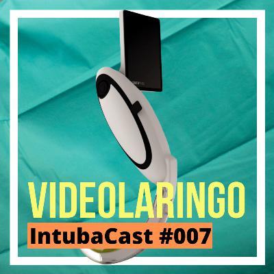 Videolaringoscópios | Intubacast #007