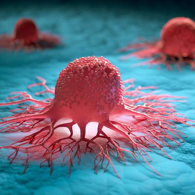 EL CÁNCER, SUS CAUSAS Y CÓMO PREVENIRLO 👩⚕️ Aprende Fácil sobre Salud y Medicina ❤️️ EL CÁNCER, SUS CAUSAS Y CÓMO PREVENIRLO 👩⚕️ Aprende Fácil sobre Salud y Medicina ❤️️