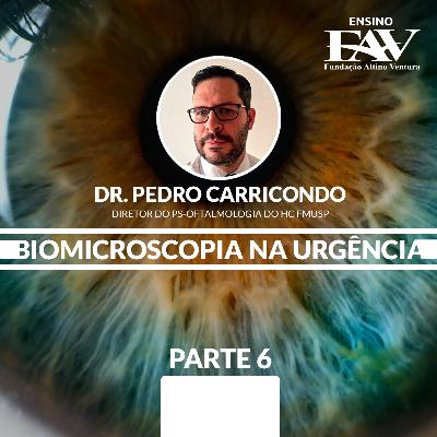 Biomicroscopia na Urgência - Parte 6 │ Dr. Pedro Carricondo │ Ensino FAV