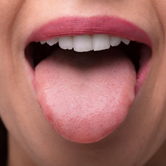 The OPTISMILE Podcast 101 - Tongue Tie, Tongue Posture and Mewing - What Adults Need to Know