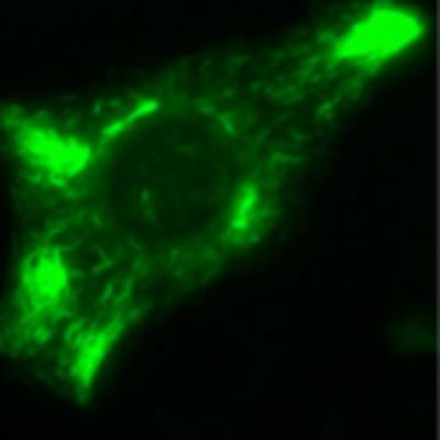 The role of Vimentin in Regulating Cell Invasive Migration