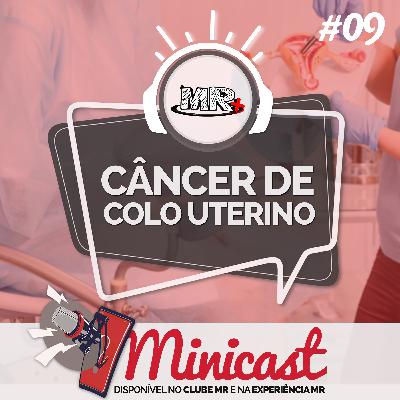 Minicast 09 - Câncer de colo uterino