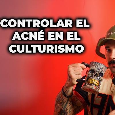 EP 50 - Acne en el culturismo ¿Se puede evitar? EP 50 - Acne en el culturismo ¿Se puede evitar?