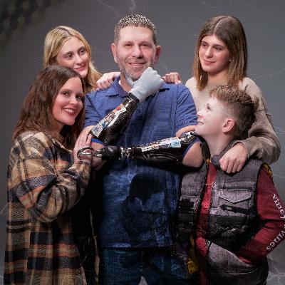 Jason Koger: First Bilateral Arm Amputee in the World to Receive 2 Bionic Hands & Author of Handed a Greater Purpose