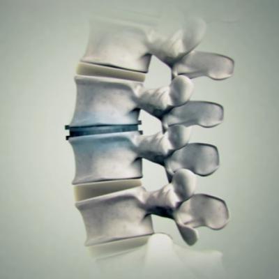 Pain Science and Injury