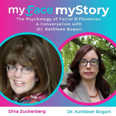 The Psychology of Facial Differences: A Conversation with Dr. Kathleen Bogart