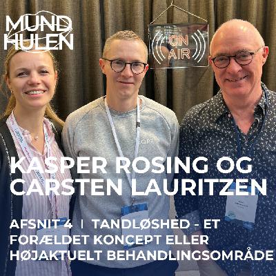 Afsnit 4 - Tandløshed - et forældet koncept eller højaktuelt behandlingsområde med Kasper Rosing og Carsten Lauritzen