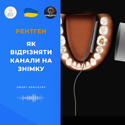 Як відрізняти канали на знімку