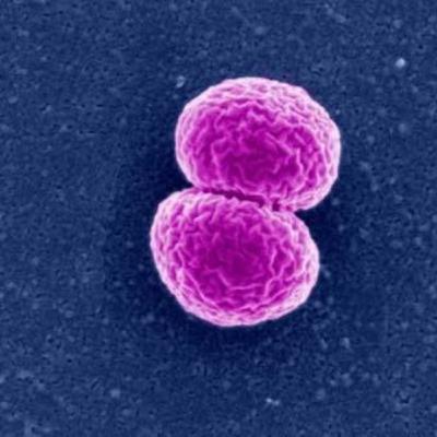INFECTOLOGIA; NEISSERIA MENINGITIDIS