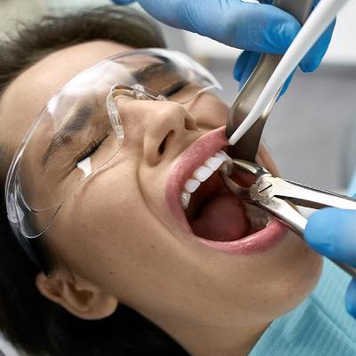 Audio Article: Research Investigates Patient and Practitioner Perspectives on Tooth Extractions without Clinical Justification