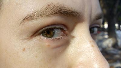 ¿Por qué tenemos dos ojos?