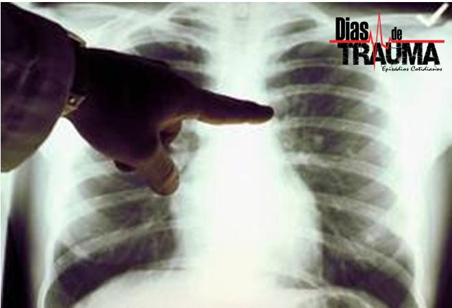 Dias de Trauma - A Mancha no Pulmão episode artwork