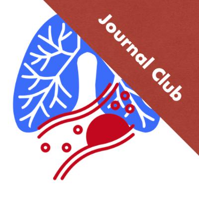 Can D-dimer be Used and Useful in High Pre-Test Probability PE Patients?