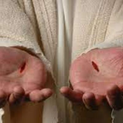 He Had The Scars To Prove It