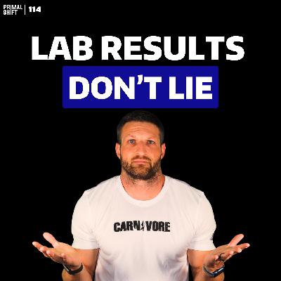 114: The Dirty Secret in Protein Powders – What Consumer Reports Found! 114: The Dirty Secret in Protein Powders – What Consumer Reports Found!