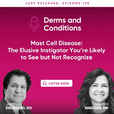 Mast Cell Disease: The Elusive Instigator You’re Likely to See but Not Recognize Mast Cell Disease: The Elusive Instigator You’re Likely to See but Not Recognize