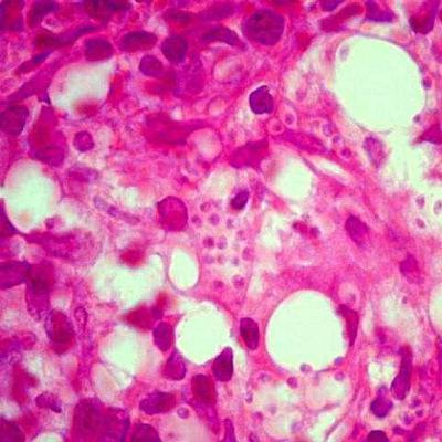 Leishmaniose Visceral Canina: como diagnosticar PARTE 2.