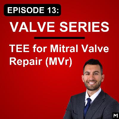 13. TEE for Mitral Valve Repair (MVr) Surgery
