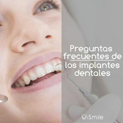 Preguntas frecuentes de los implantes dentales