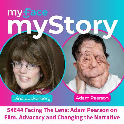 Facing The Lens: Adam Pearson on Film, Advocacy and Changing the Narrative