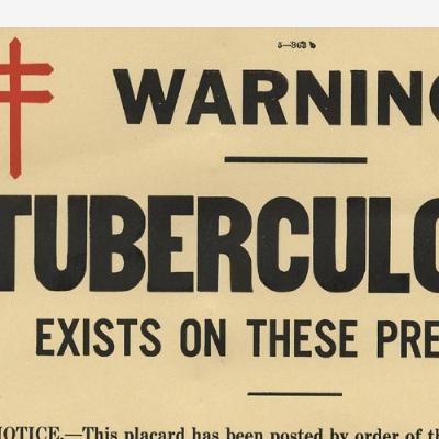 250. This is Tuberculosis- ain't no hold 'em