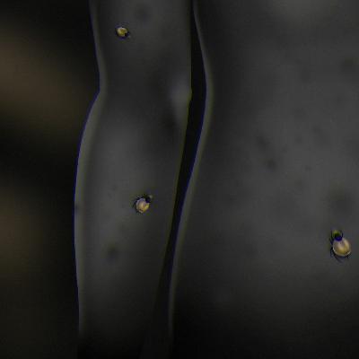 Ticks
