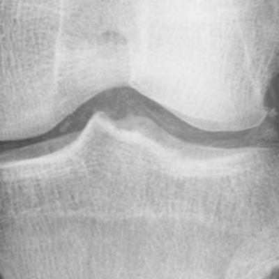 Calcium: Ein guter Grund - mit Dr. Stefan Hügel