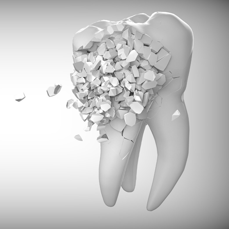 The OPTISMILE Podcast 97 - Cracked Tooth Syndrome - The Invisible Pain