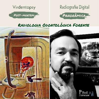 Radiologia Forense - Virdentopsy
