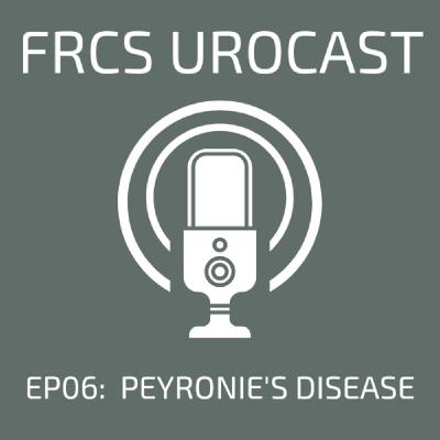 Episode 6: Peyronie's disease (with Vaibhav Modgil) Episode 6: Peyronie's disease (with Vaibhav Modgil)