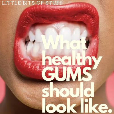 What Healthy Gums Should Look Like